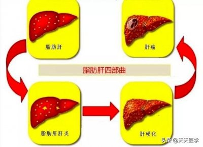 ​死于肝癌的明星