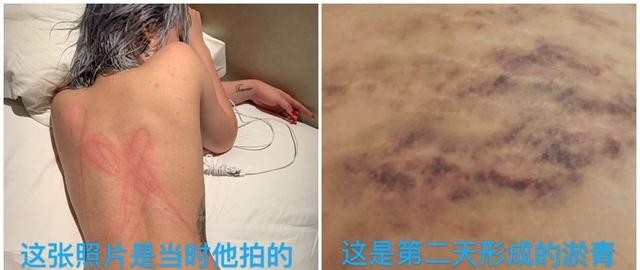屈楚萧生理反应（屈楚萧遭前女友爆料性丑闻）