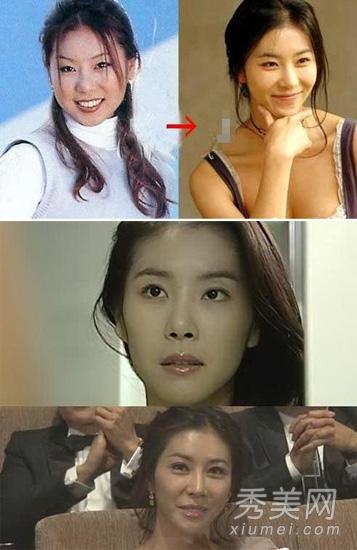 李多海整容前后