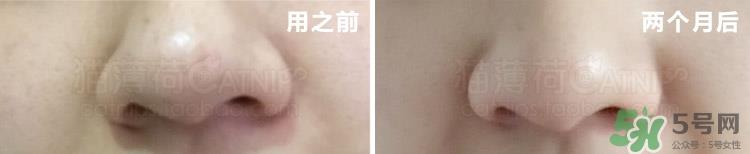 乐敦cc精华多少钱?乐敦cc精华日本专柜价格 乐敦cc精华多少钱?乐敦cc精华日本专柜价格