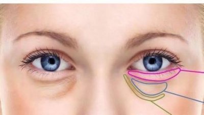 ​消除眼袋这七种方法最有效（三步快速消除眼袋的小技巧）