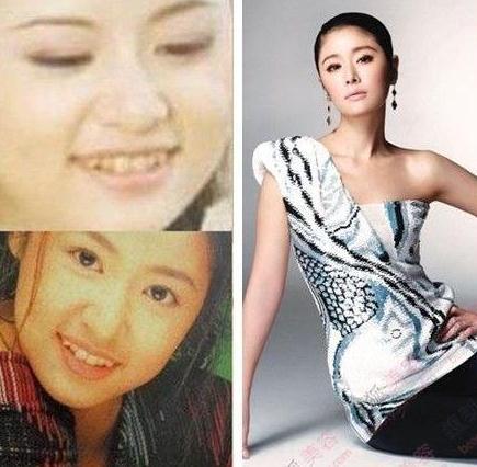 林心如整容前后