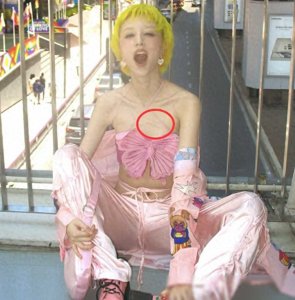 ​华晨宇女友瘦成纸片人，吊带露伤痕引关注，网友送祝福！